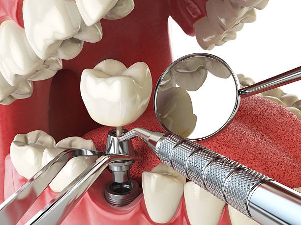 Best Holiday Emergency Dentist in Greenville, SC