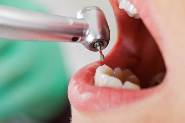 Best Emergency Cosmetic Dentistry in Greenville, SC